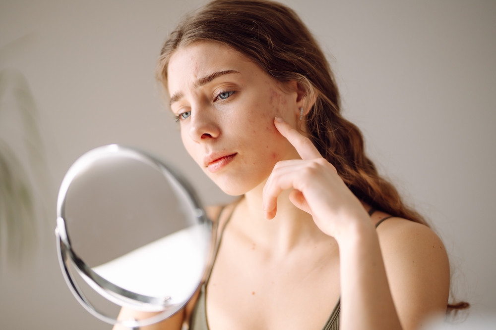 Young woman with long brown hair examining her acne-prone skin in a handheld mirror, looking concerned while gently touching her cheek.