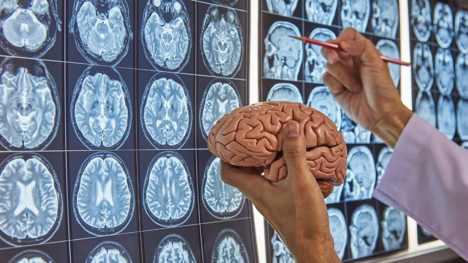 The potential of focused ultrasound in Alzheimer’s care