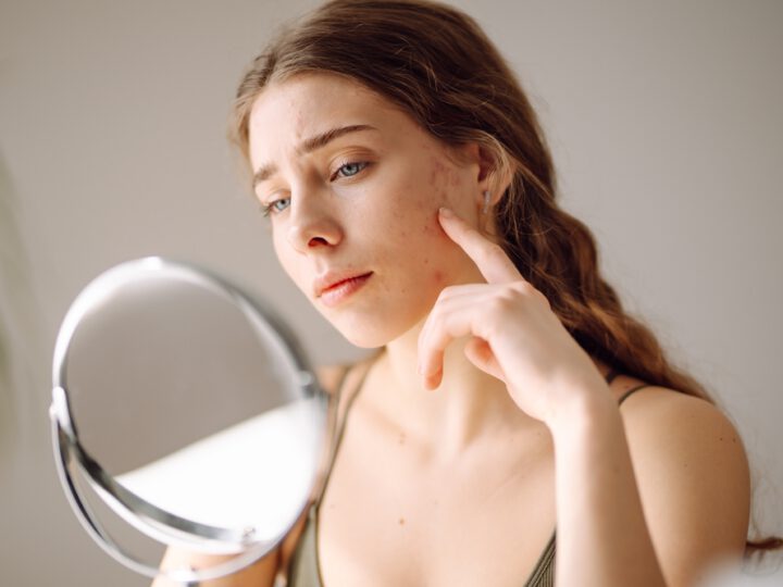 Young woman with long brown hair examining her acne-prone skin in a handheld mirror, looking concerned while gently touching her cheek.