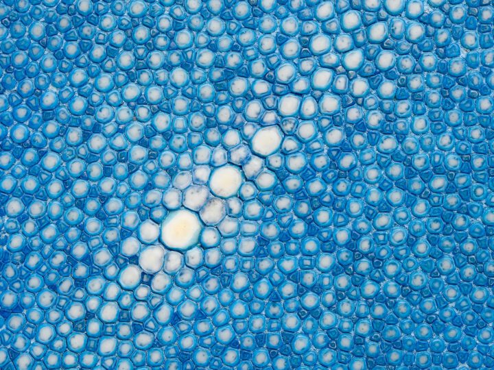 Arctic Therapeutics Announces Enrollment of First Patients in Phase IIa Trial of AT-004 for Acne Vulgaris