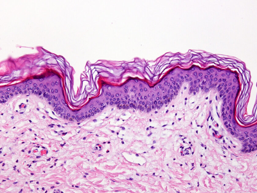 Epidermis,Of,The,Thin,Skin.,It,Can,Be,Identified,The